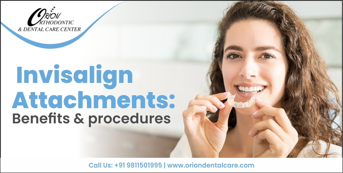 Invisalign attachments: Benefits & procedures - Orion Dental Care