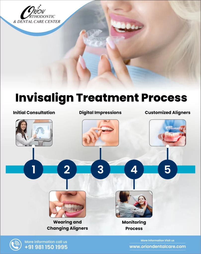 How Do Invisalign® Aligners Work ?, Invisalign Treatment Process