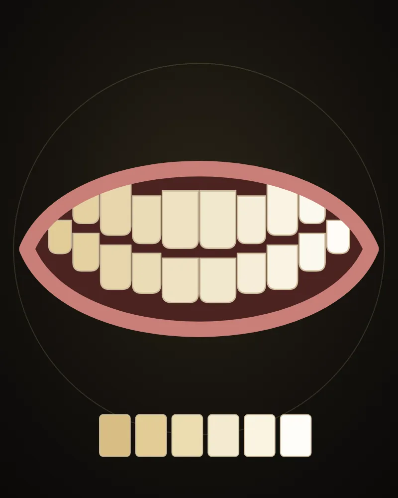 An illustration of a tooth being whitened