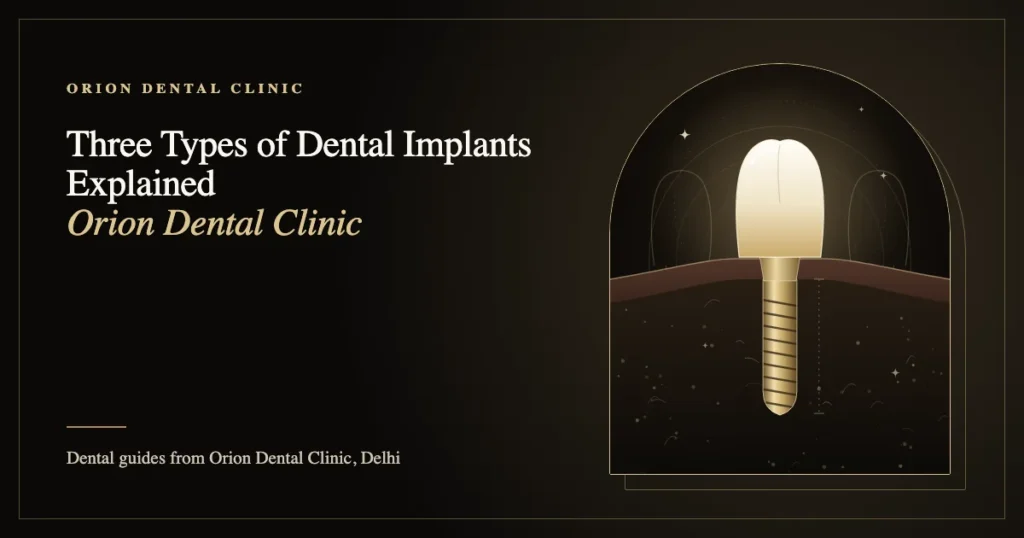 Three Types of Dental Implants Explained | Orion Dental Clinic guide