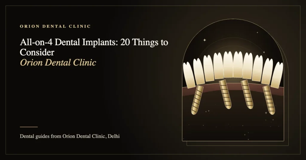 All-on-4 Dental Implants: 20 Things to Consider | Orion Dental Clinic guide