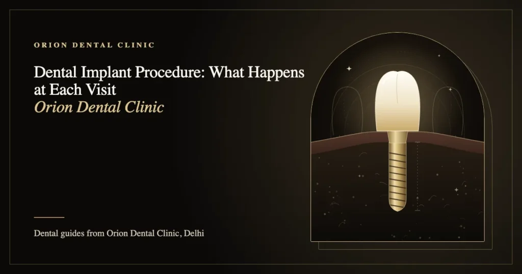 Dental Implant Procedure: What Happens at Each Visit | Orion Dental Clinic guide