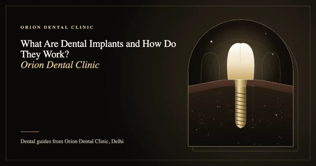 What Are Dental Implants and How Do They Work? | Orion Dental Clinic guide