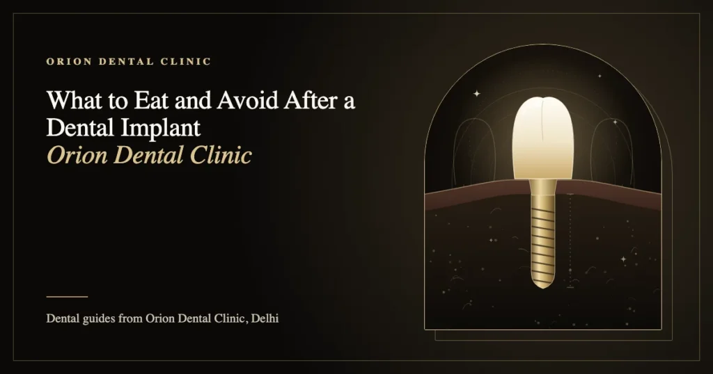 What to Eat and Avoid After a Dental Implant | Orion Dental Clinic guide